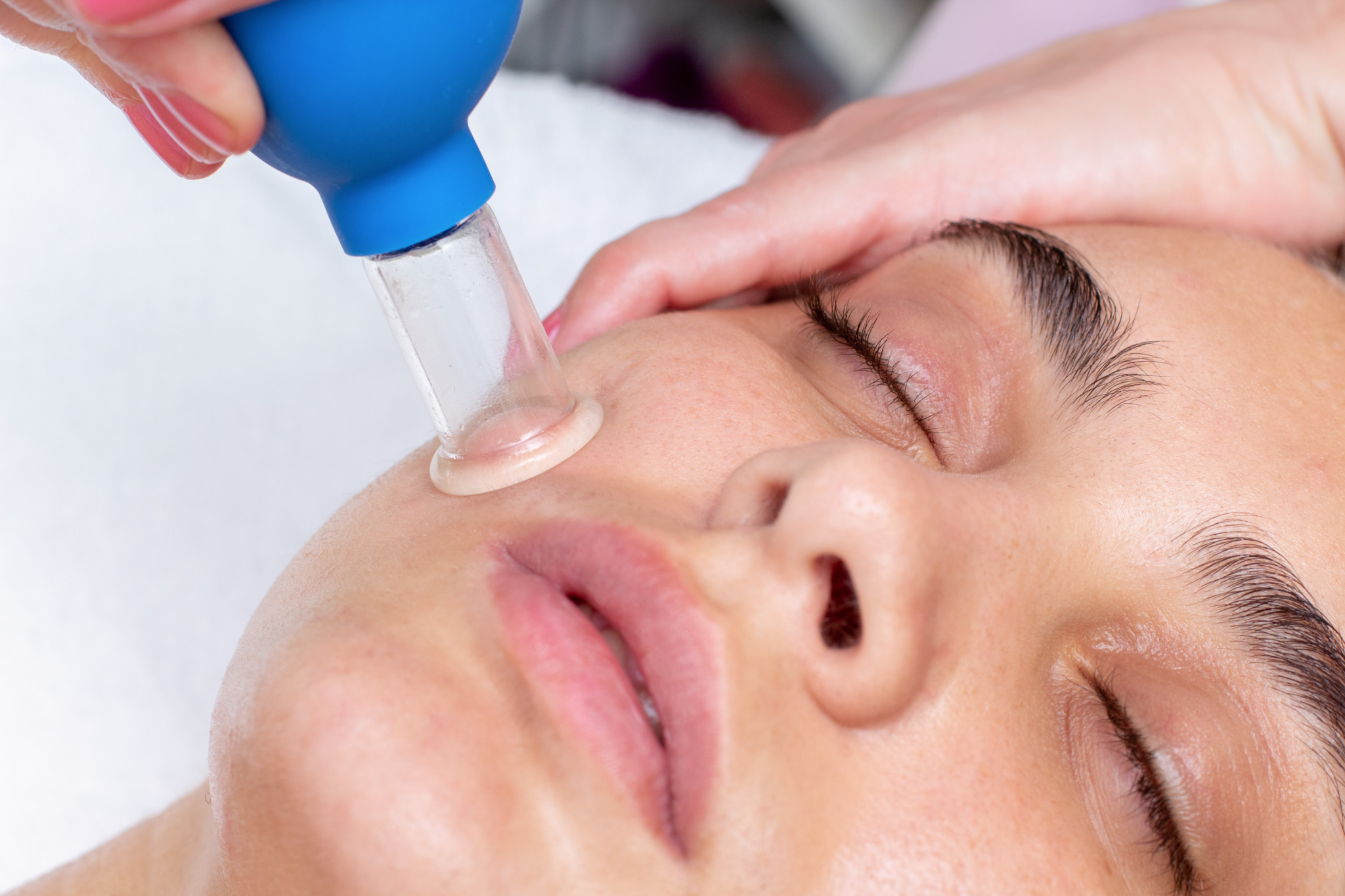 Face Cupping